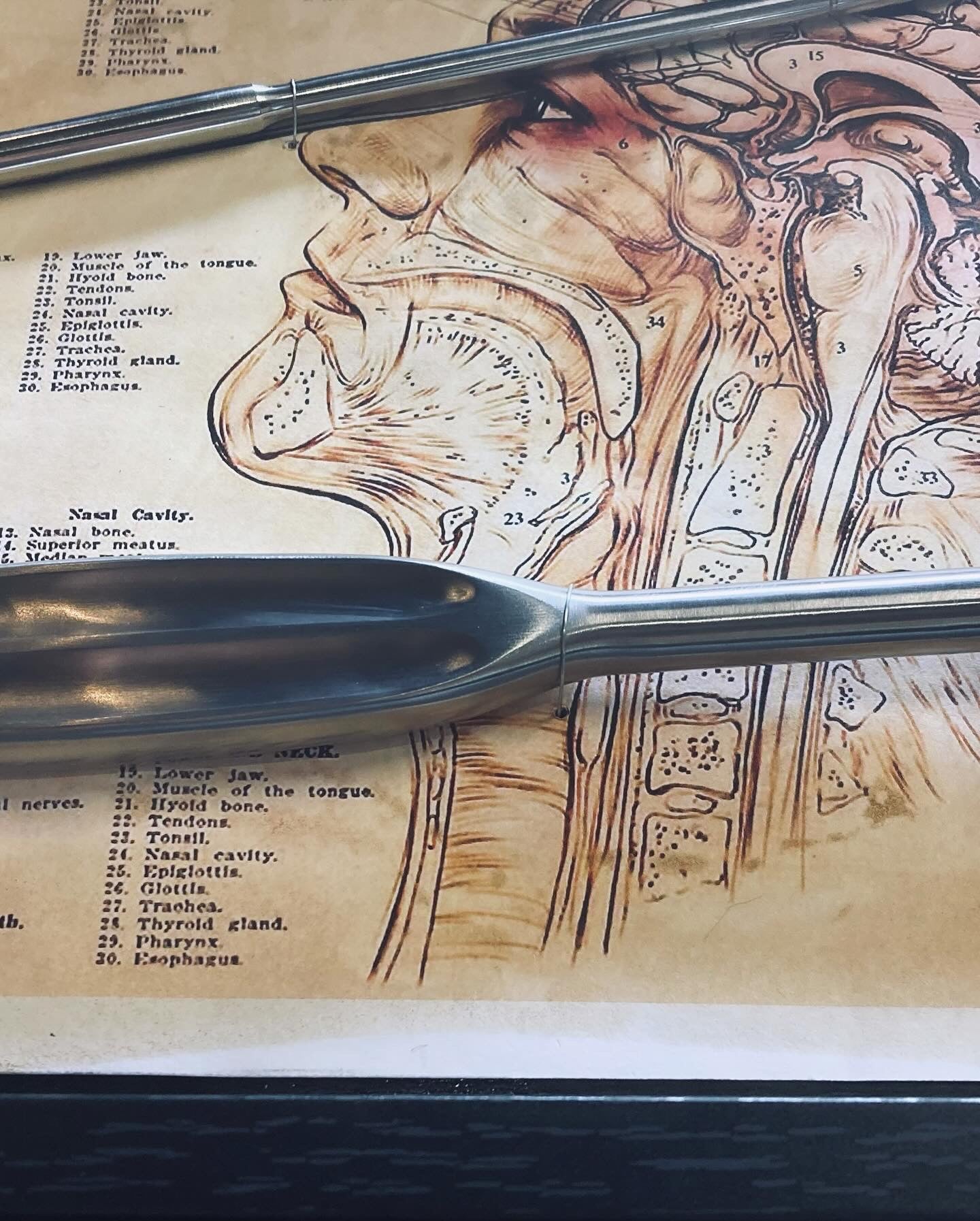 Vintage Lobotomy Kit - Tools and Poster in Shadow Box M202