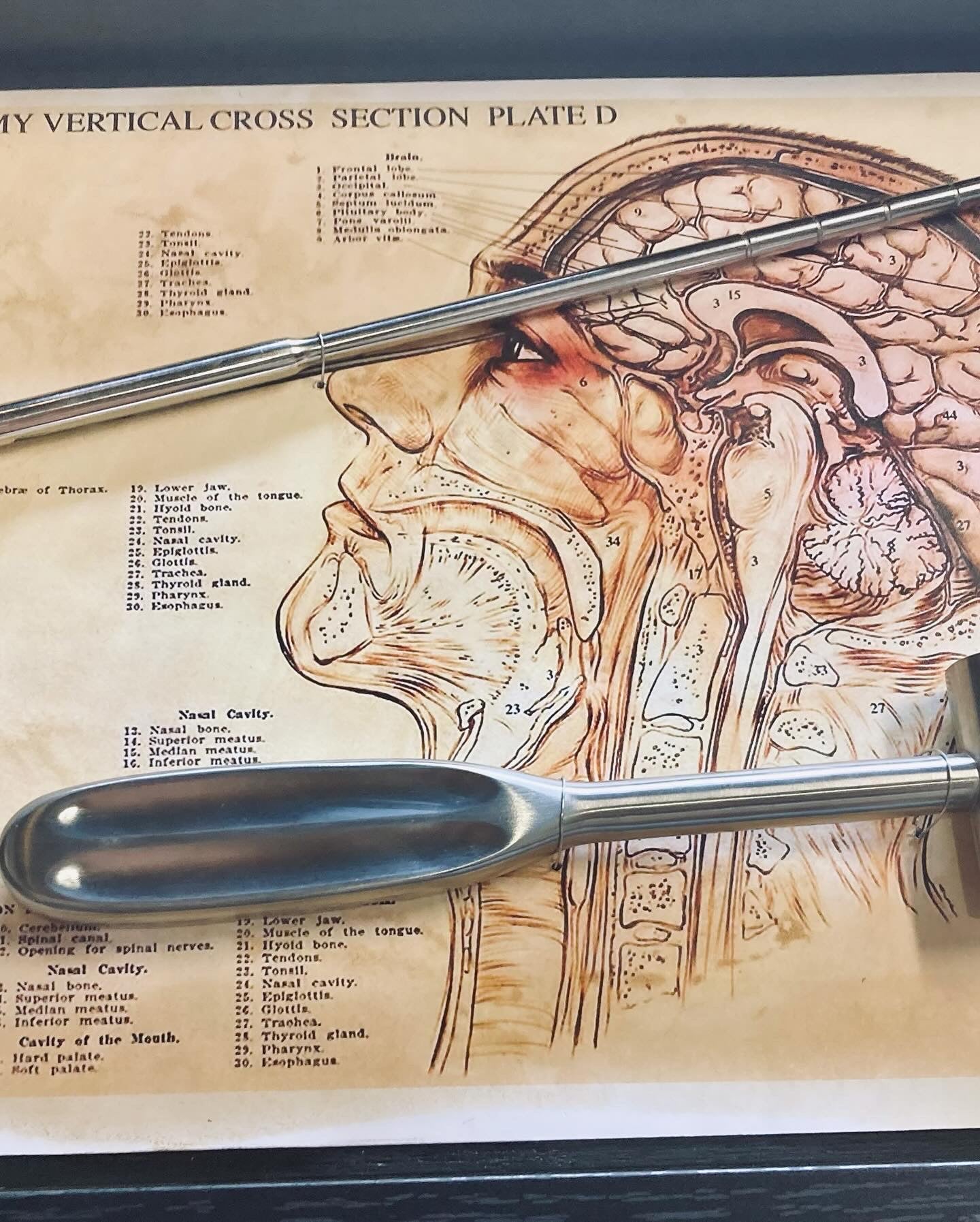 Vintage Lobotomy Kit - Tools and Poster in Shadow Box M202