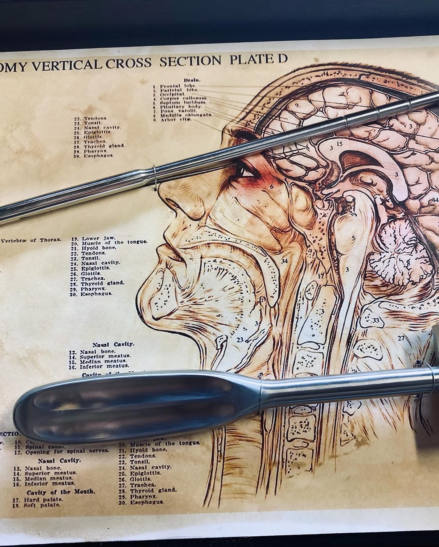 Vintage Lobotomy Kit - Tools and Poster in Shadow Box M202