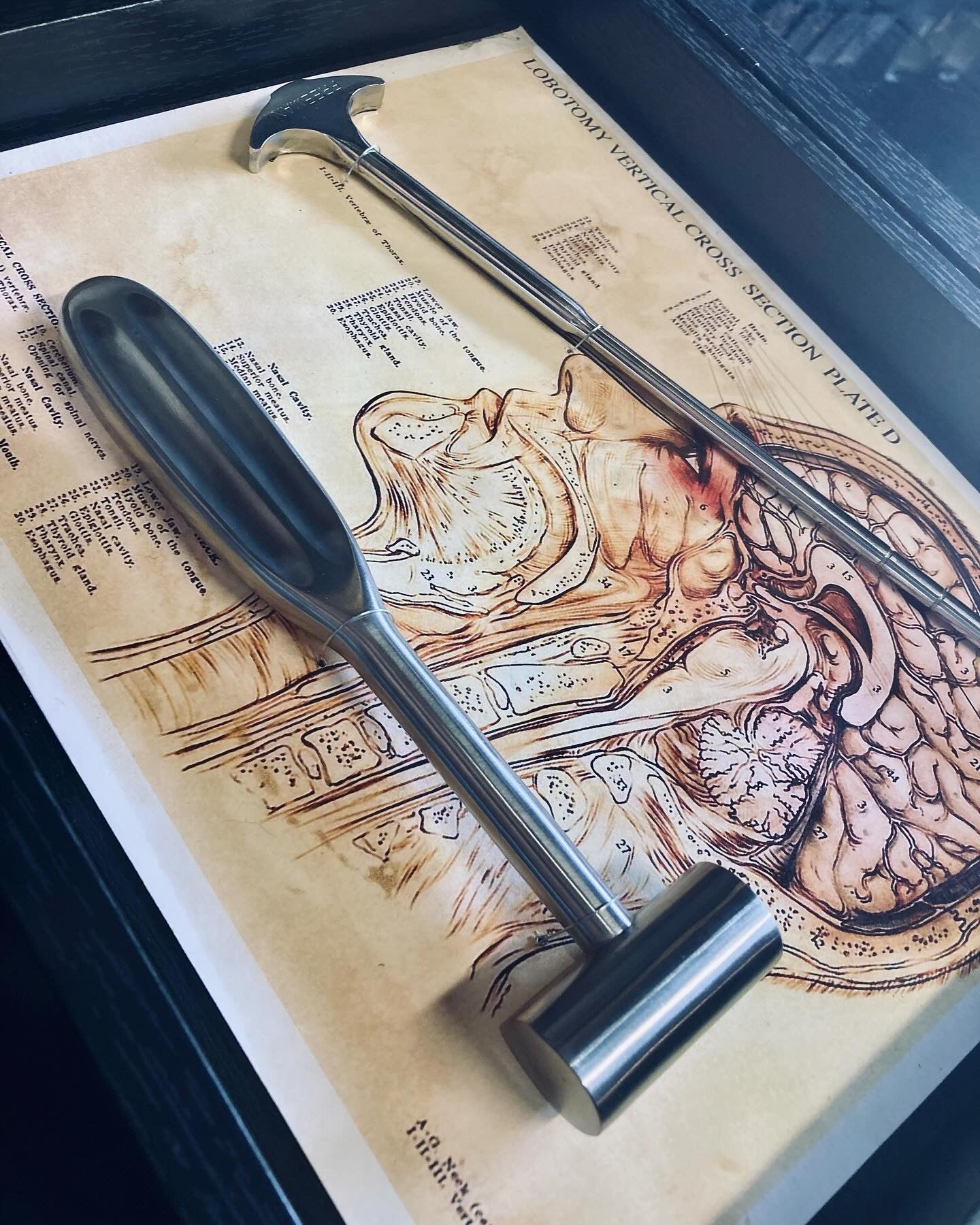 Vintage Lobotomy Kit - Tools and Poster in Shadow Box M202